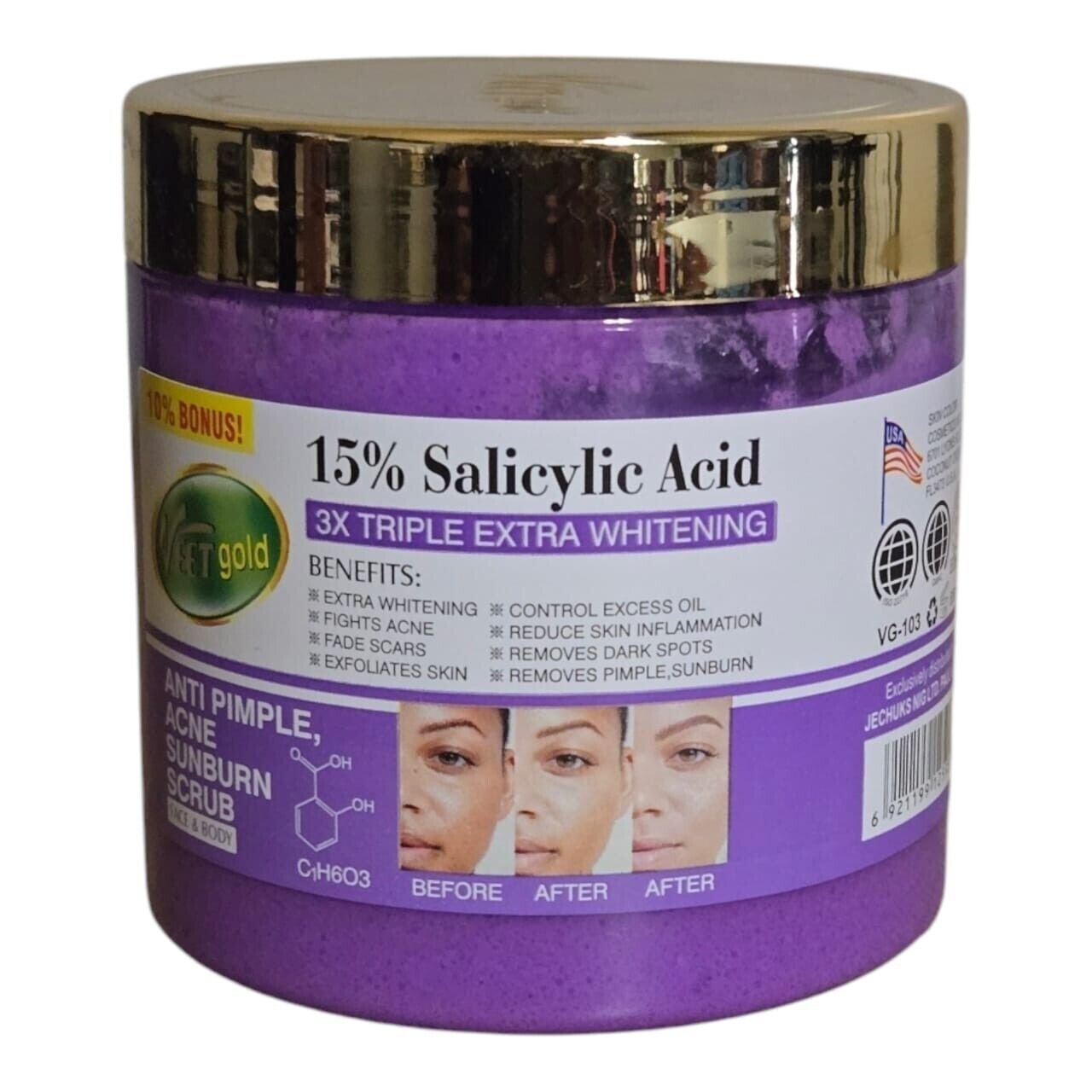 1000389349.jpg Veet Gold 15% Salicylic Acid 3×Triple Extra Whitening Anti Pimple, Acne Sunburn Scrub(face &body) 650g - Image 1