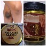 Dark kunckles clear bsc (250g)